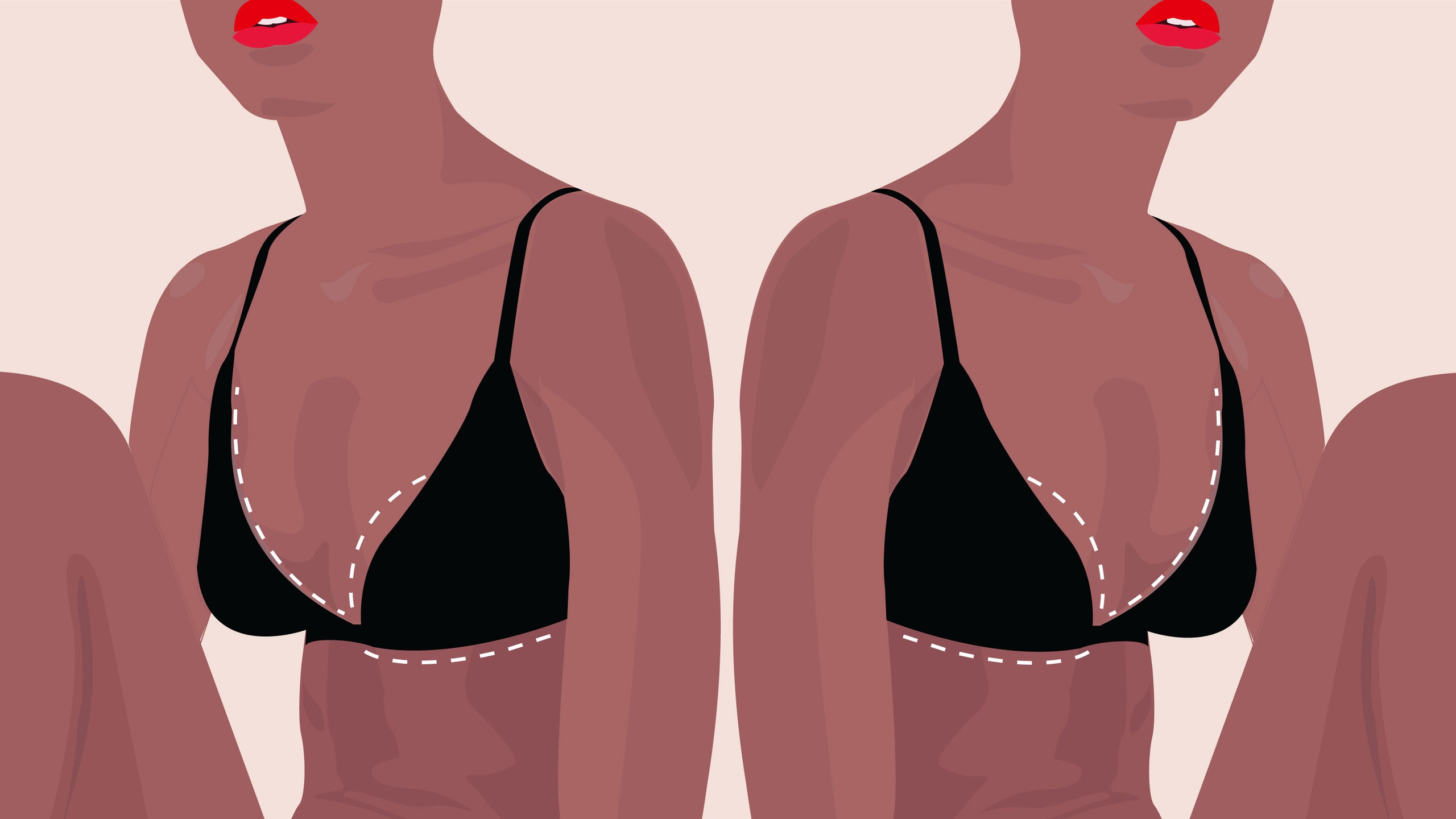 How Much Weight is Removed in Breast Reduction